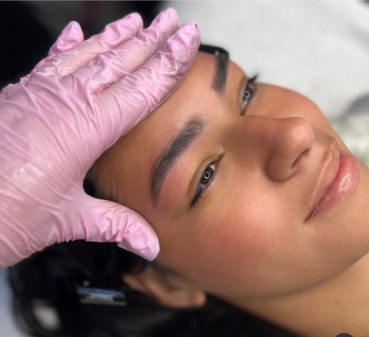 Estética Facial